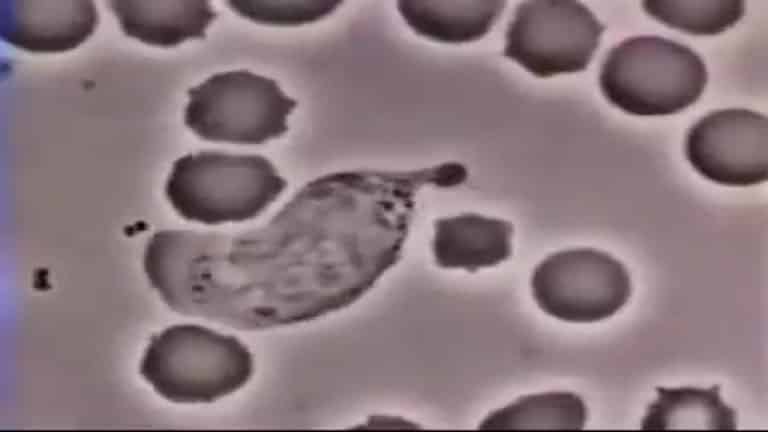 White Blood Cell Chases Bacteria | Video | Abakcus