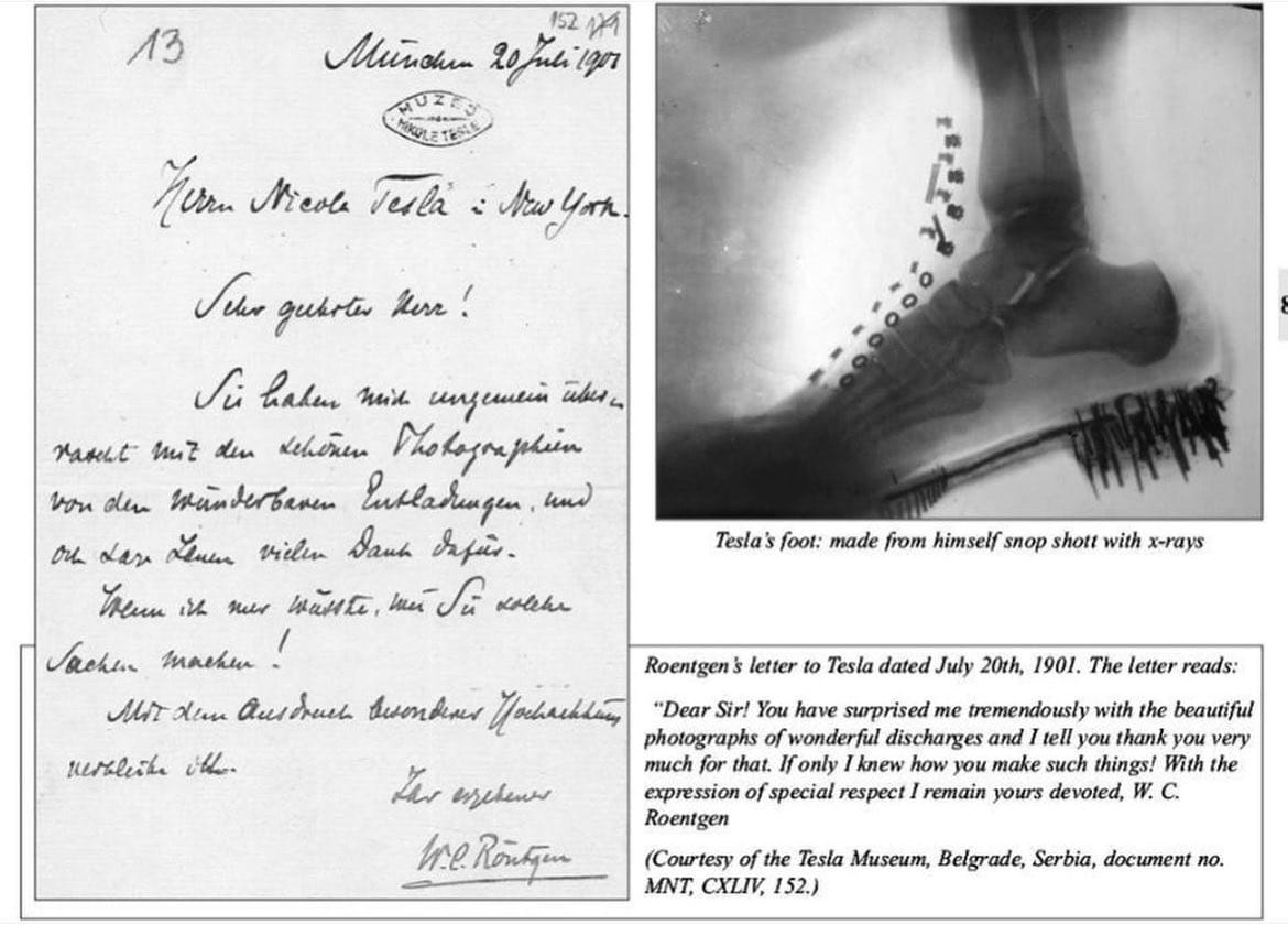 Nikola Tesla and the X-Ray That Started It All 1 Nikola Tesla captured an X-ray image of his own foot