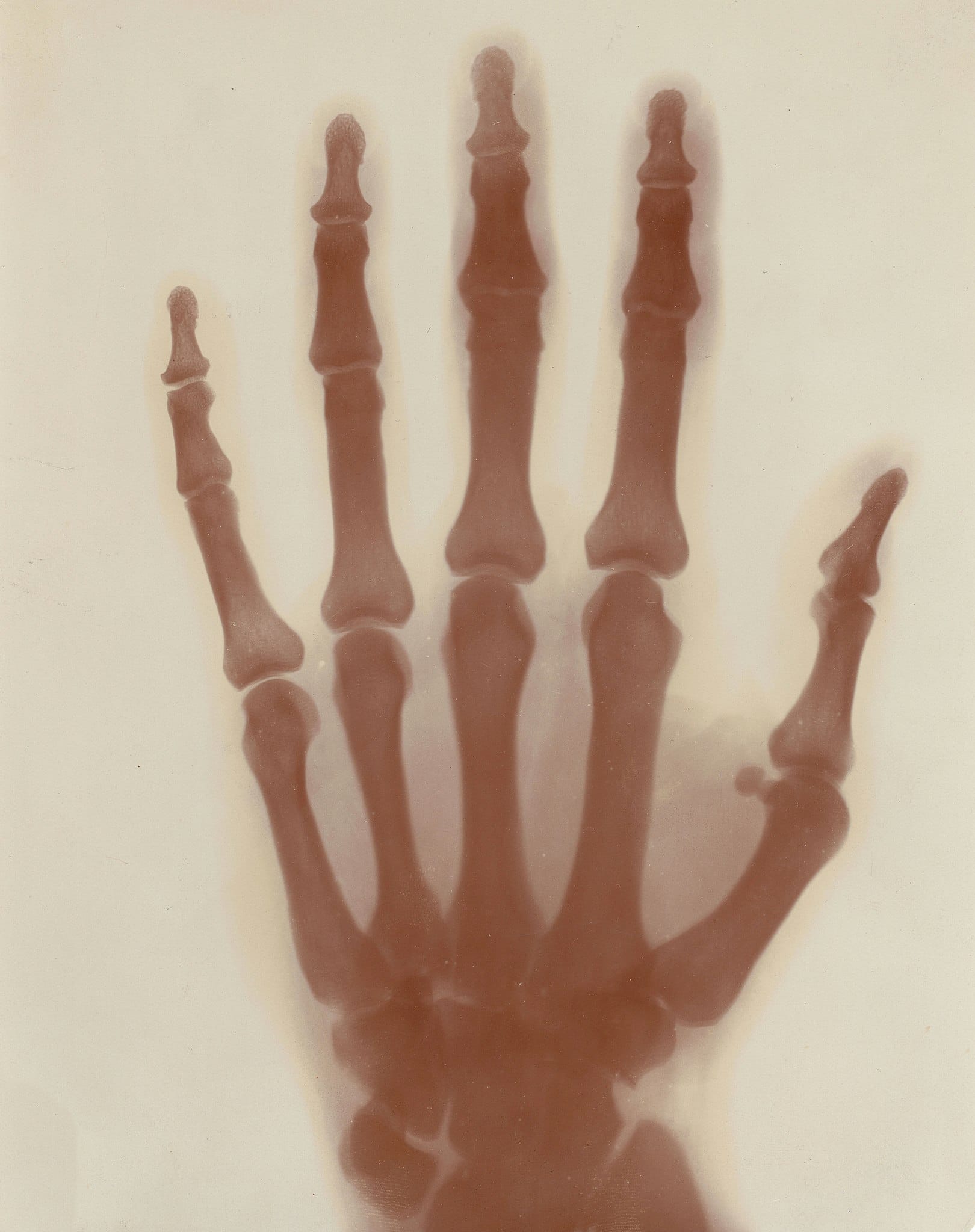 Nikola Tesla and the X-Ray That Started It All 2 X-Ray Photograph of Tesla's left hand